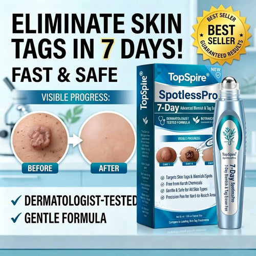 TopSpire® SpotlessPro Advanced Skin Care Pen