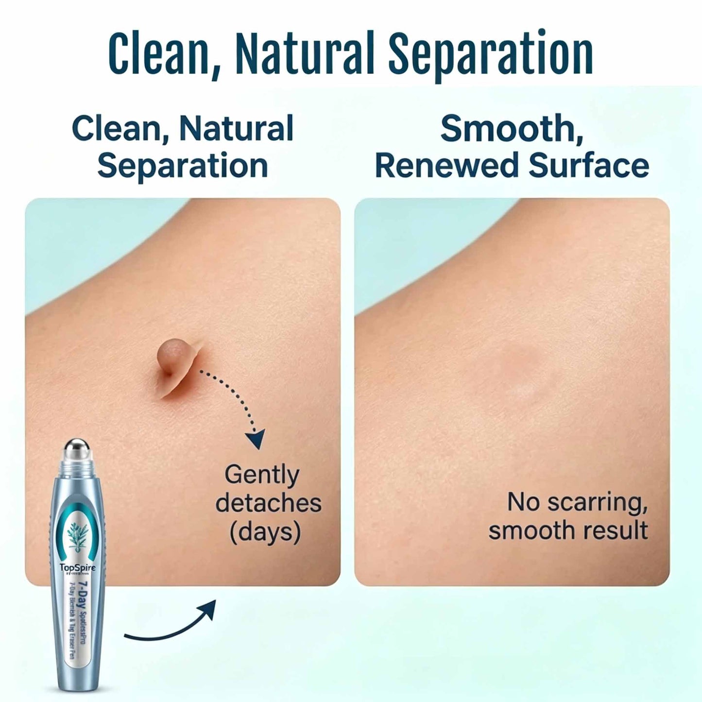 TopSpire® SpotlessPro Advanced Skin Care Pen