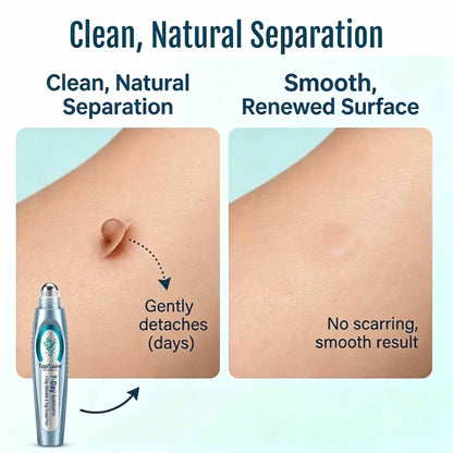 TopSpire® SpotlessPro Advanced Skin Care Pen