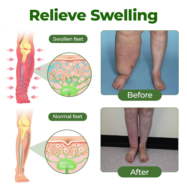 TopSpire® Professional Leg Circulation Cream