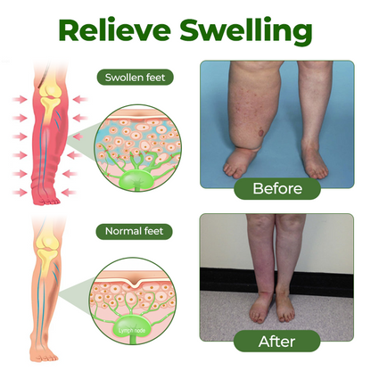 TopSpire® Professional Leg Circulation Cream