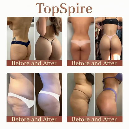 TopSpire™ CurveSculpt Micro-Patch ✦ Sculpt • Firm • Smooth Lower Body Curves ✦ Micro-Needle Infusion System