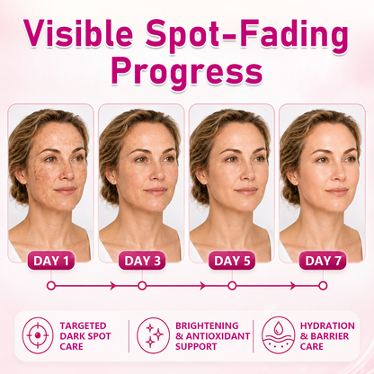 TopSpire® Dark Spot Correcting & Brightening Cream