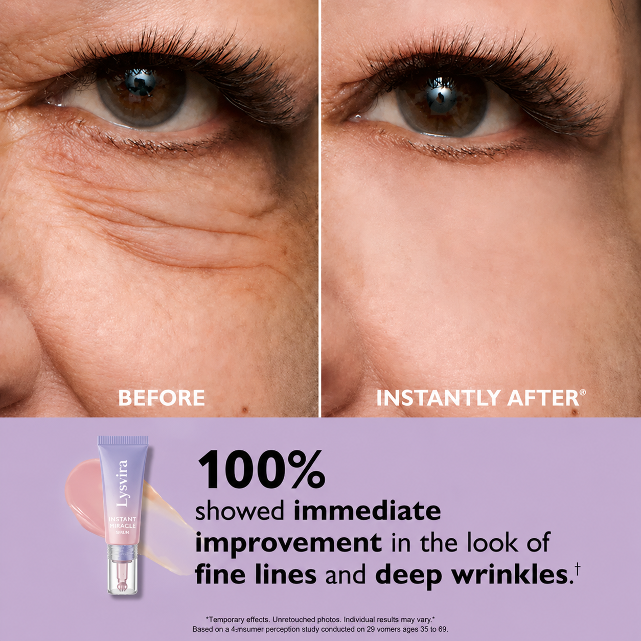 Fempick Eye Bag Instant Eraser, Tightens, Firms, & Blurs Wrinkles