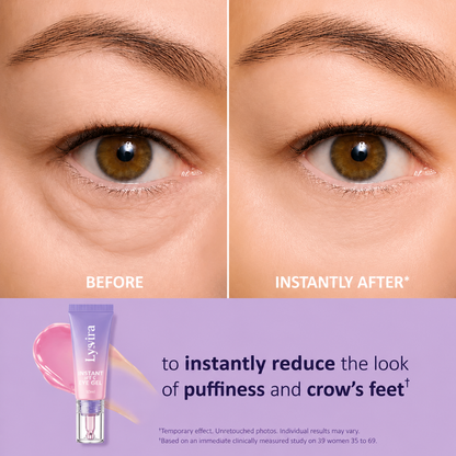 Fempick Eye Bag Instant Eraser, Tightens, Firms, & Blurs Wrinkles